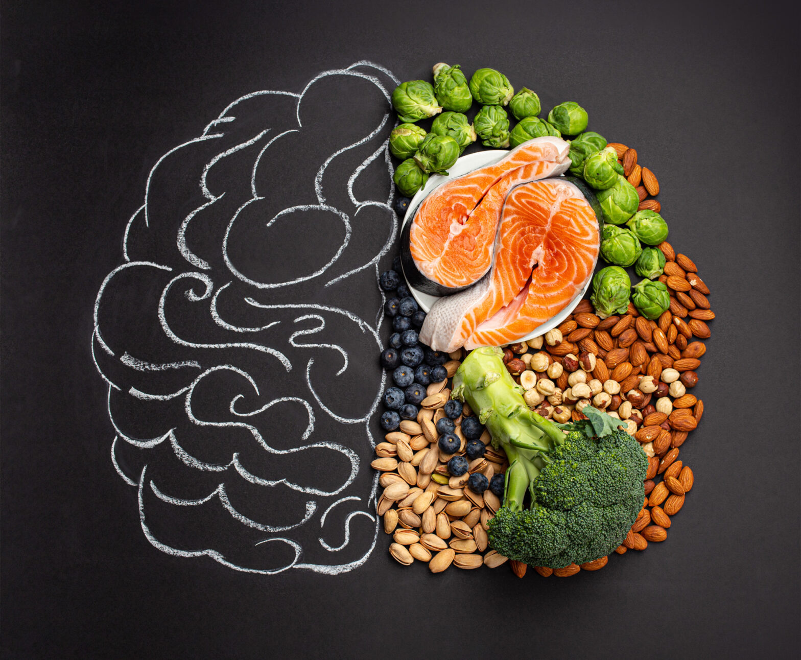 nutritivni pristup mentalnom zdravlju